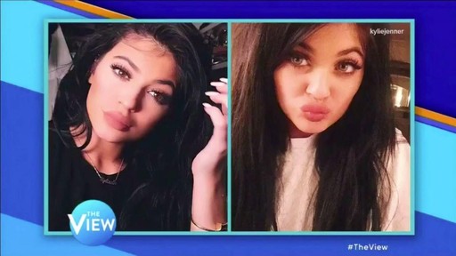 The Kylie Jenner Lip Challenge Her Lie And What Else We Cant Believe Jimmy Kimmel Live 