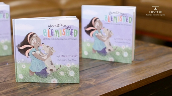 Beautifully Blemished: Chicago area author empowers children with skin differences