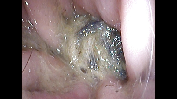 The Withering Pit Bull